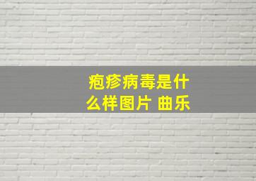 疱疹病毒是什么样图片 曲乐